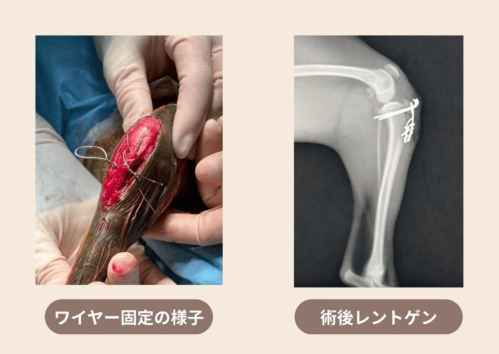 犬の脛骨近位端成長板骨折に対するワイヤー固定術の様子。左は手術中の写真で、ワイヤーで骨を固定している様子が写っている。右は術後のレントゲン画像で、ワイヤーが骨に適切に留置されているのが確認できる。