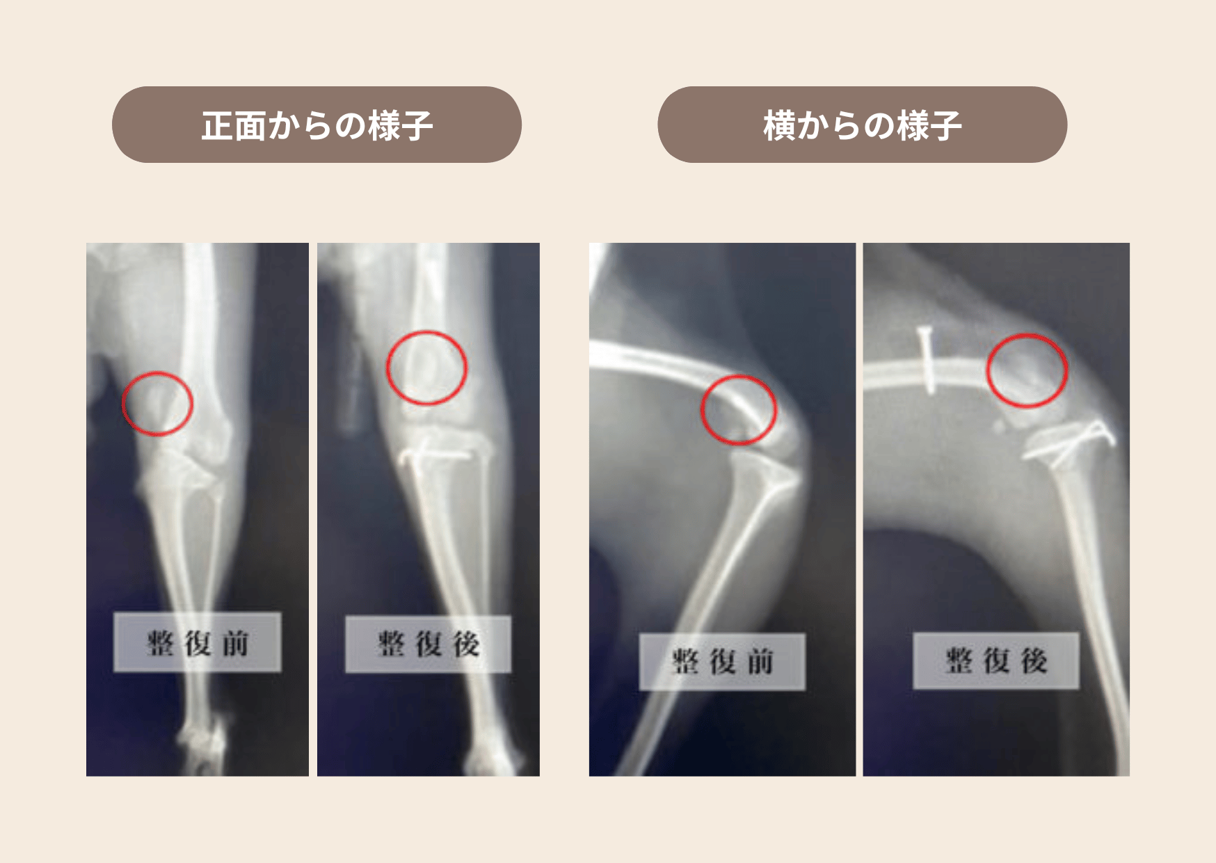 膝蓋骨脱臼(グレード4)の症例:整復前後の比較レントゲン写真(正面と横から)スクリューなどで固定されているのが分かる